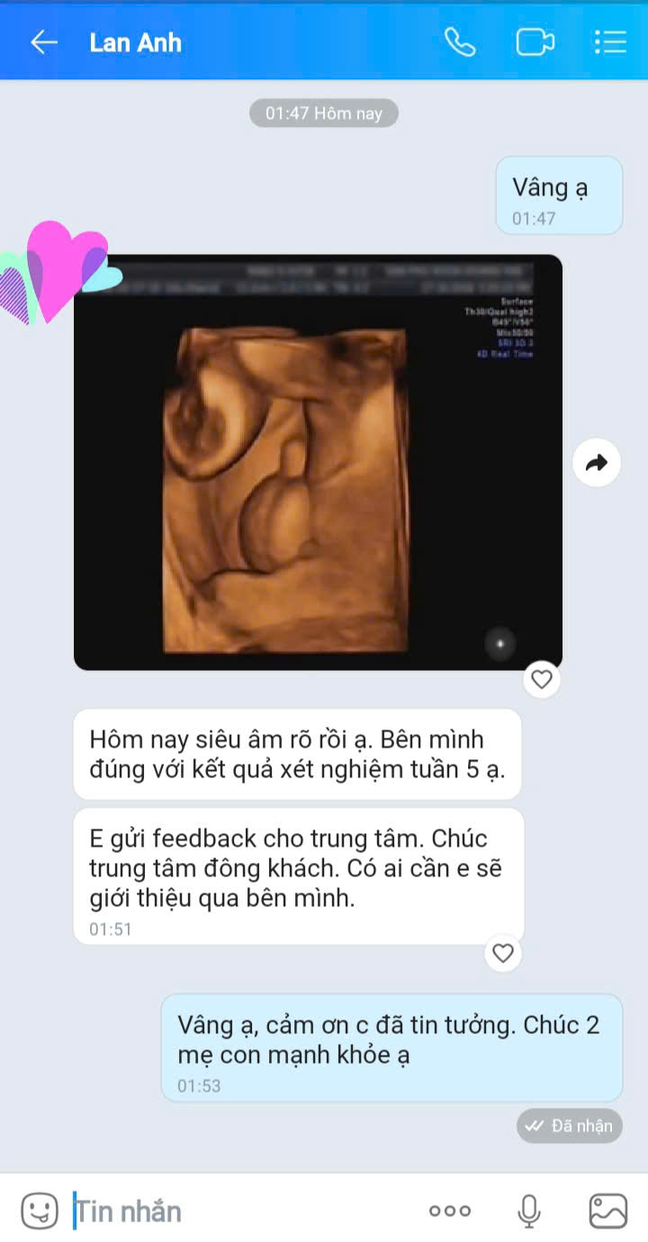 C. Lan Anh Huế